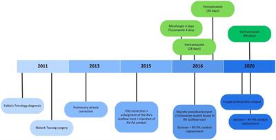 Case report: Diagnostic and therapeutic challenges of fungal endocarditis by Trichosporon asahii in a child with congenital heart defects